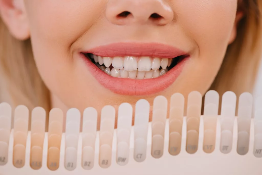 Teeth Whitening in Bronx - Sameh Aknouk Dental Service